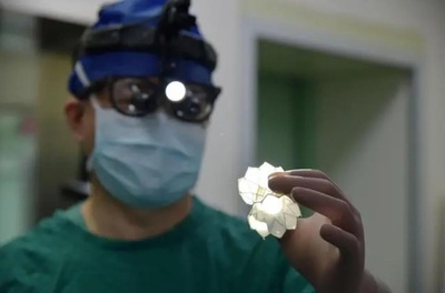 中国で開発された細胞化心臓弁膜の手術が成功