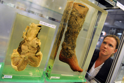 シドニーに「病気博物館」がオープン、オーストラリア