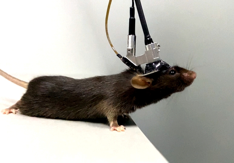 中国の科学者、「超小型３光子顕微鏡」を開発