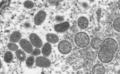 サル痘ウイルス粒子の電子顕微鏡画像。米疾病対策センター（CDC）提供（撮影日不明）。(c)AFP PHOTO / Cynthia S. Goldsmith, Russell Regnery / Centers for Disease Control and Prevention
