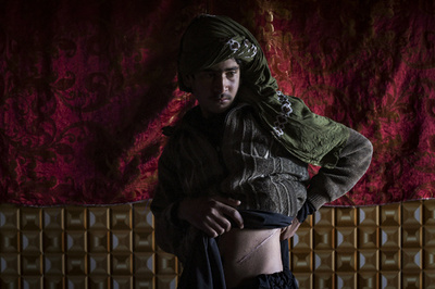 家族養うため…腎臓売るアフガン人