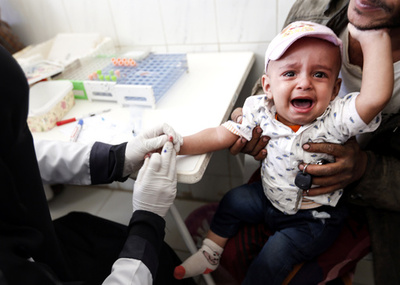 内戦で荒廃のイエメン、飢えて物乞いする子どもたち