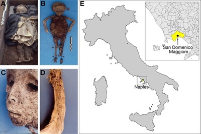 イタリアの子どものミイラ、天然痘でなく肝炎に感染 DNA分析で判明