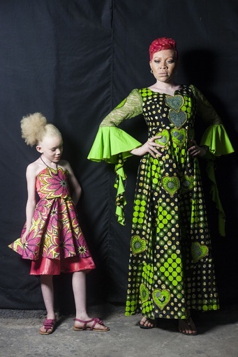 アルビノであることに誇りを、コンゴで啓発ファッションショー