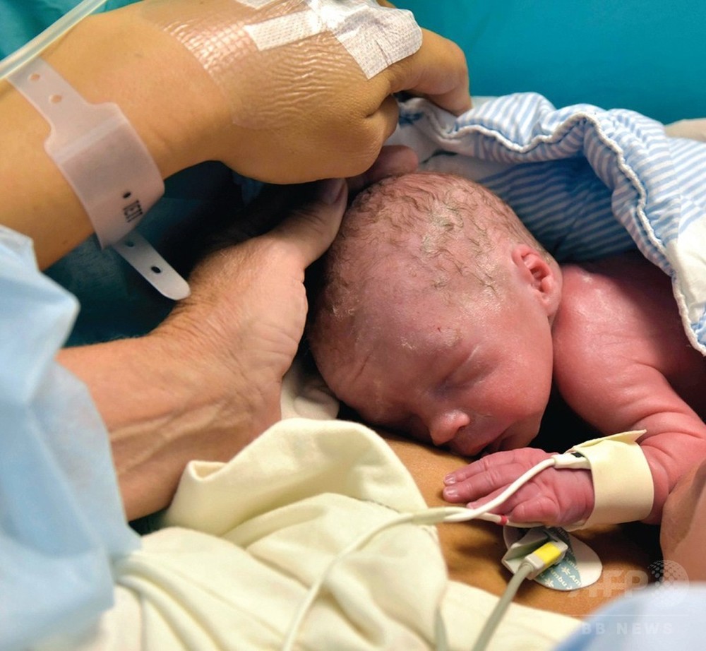 先天的に子宮がない女性が出産 世界初 閉経後のドナーから移植 写真6枚 国際ニュース Afpbb News