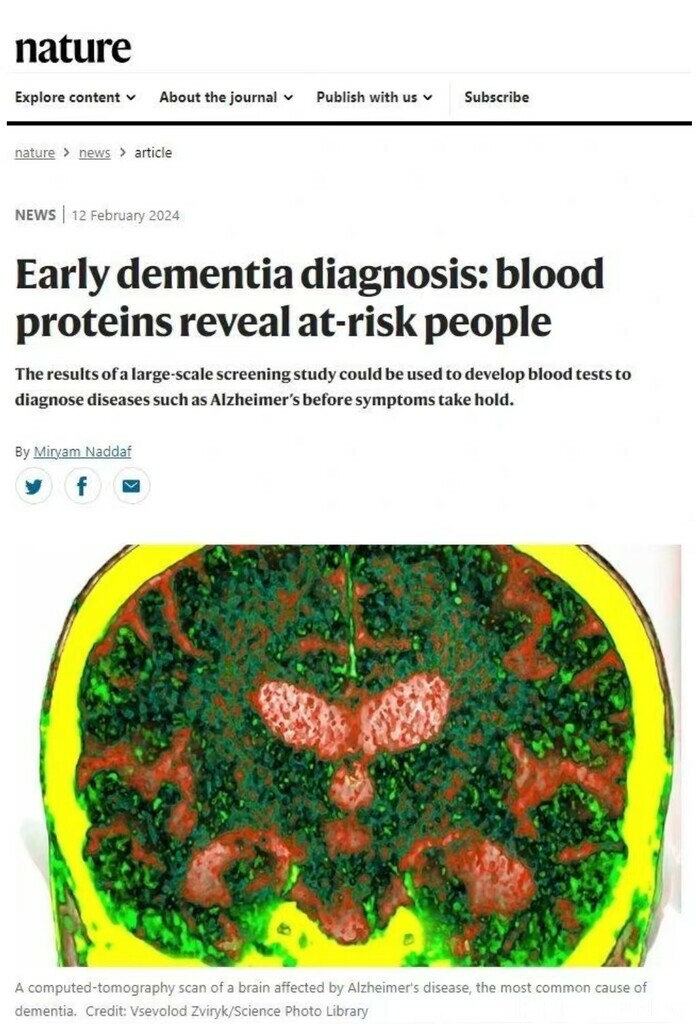 中国人による研究成果 アルツハイマー症などの早期対応・早期治療に希望