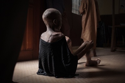 中央アフリカの飢える子どもたち、暴力と貧困が引き起こす飢餓危機