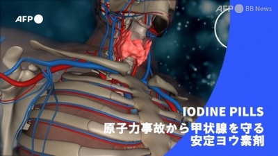 字幕:ビデオグラフィック「原子力事故から甲状腺を守る安定ヨウ素剤」