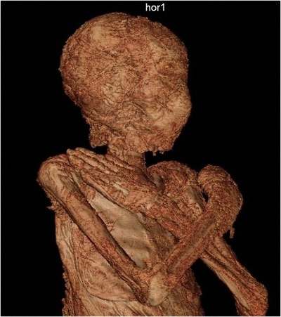 エジプトの「妊婦のミイラ」、世界で初確認 ポーランド