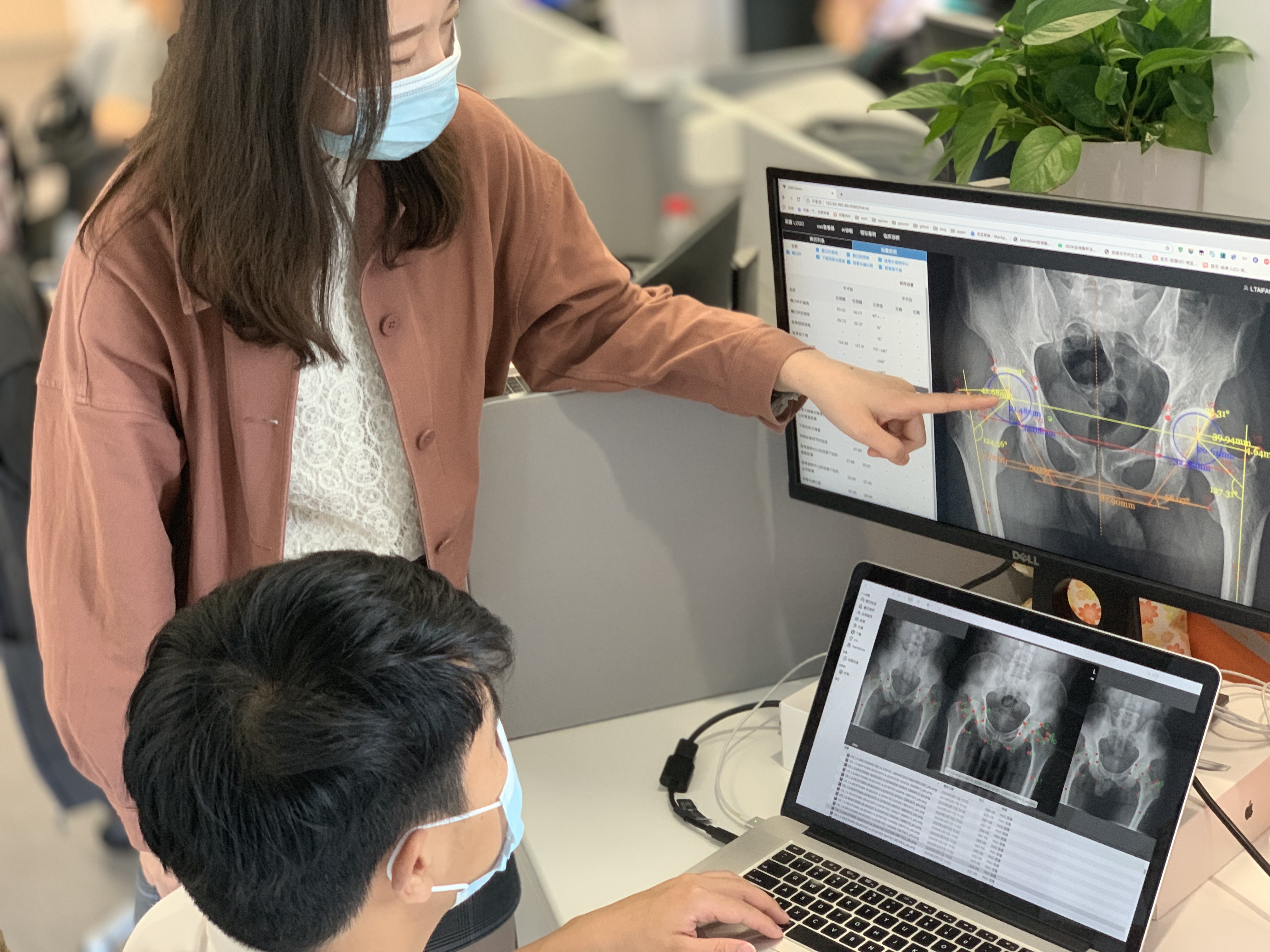 0・3秒で手術位置特定、アリババ傘下の研究機関がAI技術開発 0・3秒で手術位置特定、アリババ傘下の研究機関がAI技術開発
