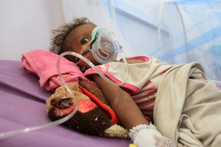 内戦のイエメン、過去数十年で世界最悪の飢餓の恐れ 国連総長