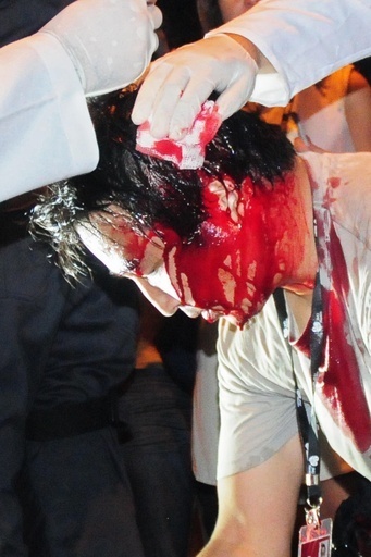 AFP日本人カメラマンが頭を負傷、デモ取材中に警棒で殴られる ブラジル