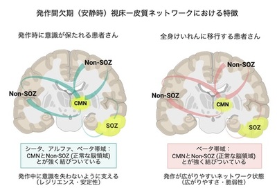【横浜市立大学】てんかん発作時の意識障害に関わる視床-皮質ネットワークの特徴を発見