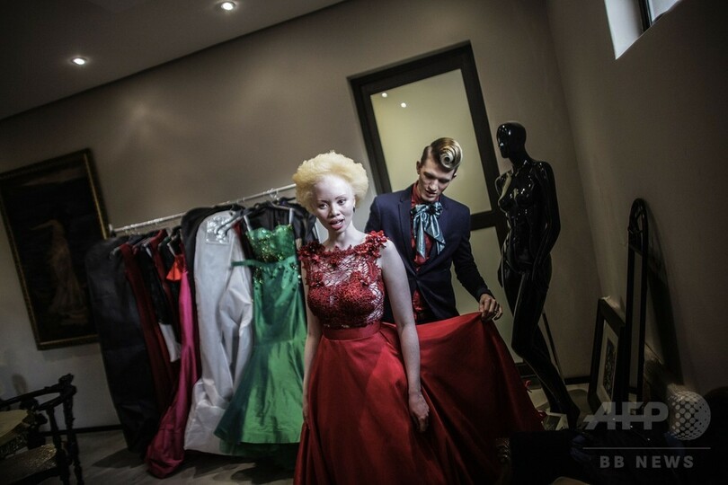 アルビノへの偏見乗り越えモデルに、南アのタンド・ホパさん