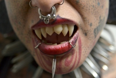 マラウイ吸血鬼騒動 自警団のリンチで2人死亡、124人逮捕