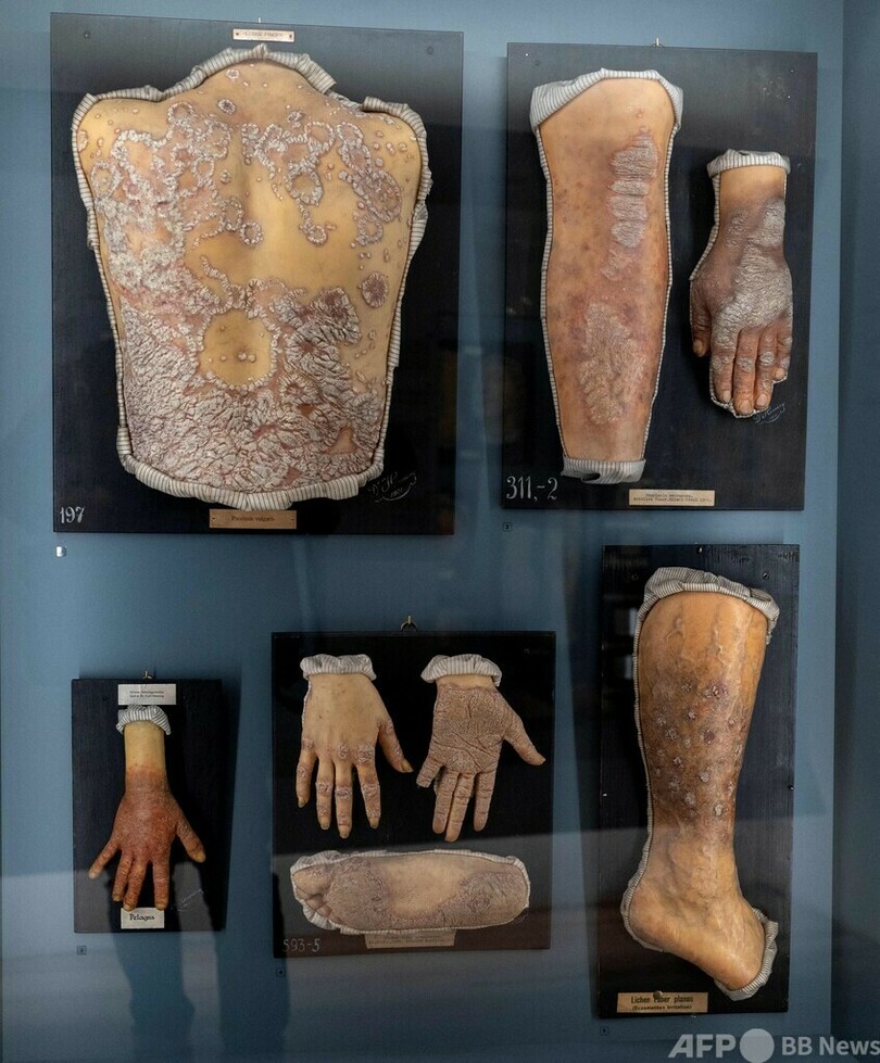 人体標本の展示、倫理と公共利益の間で ウィーン博物館
