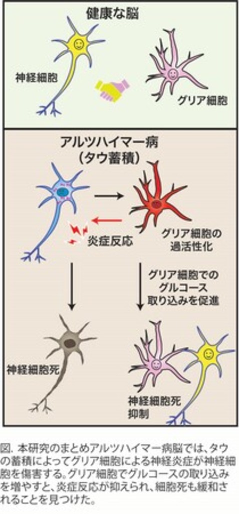 グリア細胞での糖代謝促進がアルツハイマー病の治療戦略に!?