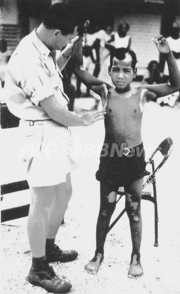 ビキニ環礁核実験