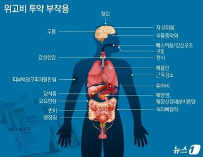 「夢の肥満治療薬」に潜む危険性…急性膵炎・小腸切除、韓国でも警鐘