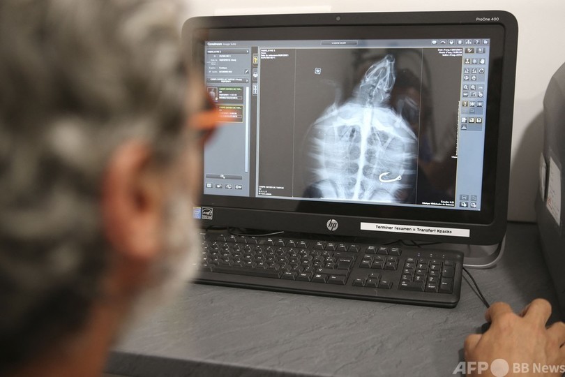 【今日の1枚】ウミガメの食道に釣り針、レントゲンでくっきり