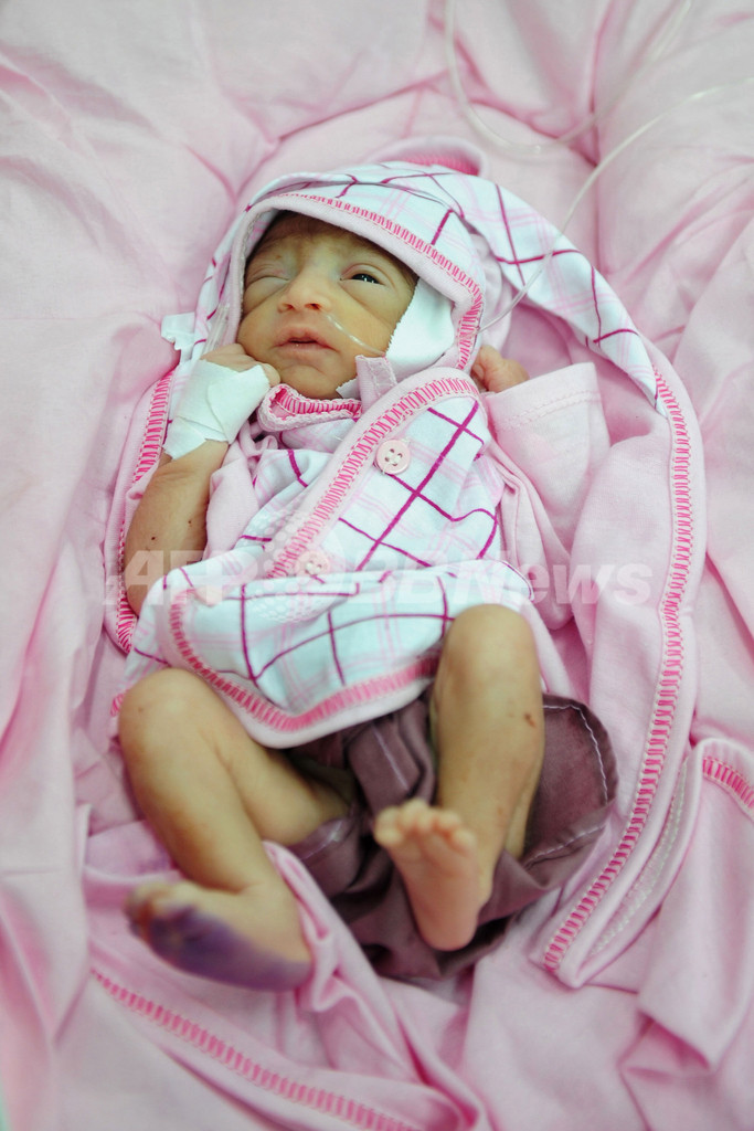 【写真特集】世界の「70億人目」の赤ちゃんたち