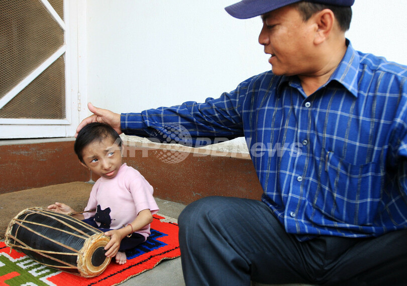 身長51センチ、世界一背の低い人物はネパール青年