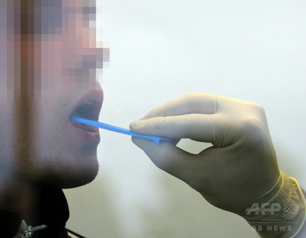 燃え尽き症候群、簡単な唾液テストで判定可能 研究 燃え尽き症候群、簡単な唾液テストで判定可能 研究