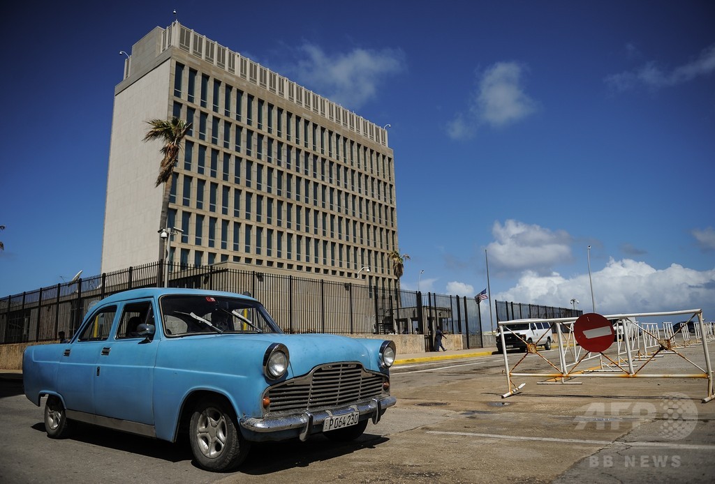 キューバで音響攻撃を受けたとする米外交官ら 捉えどころのない 脳内損傷か 写真1枚 国際ニュース Afpbb News
