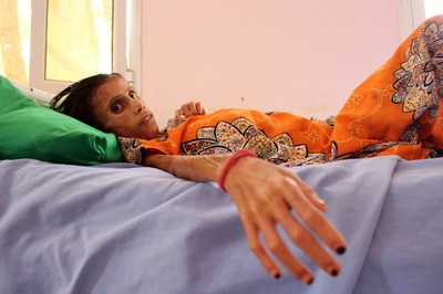 「世界最悪の飢餓」