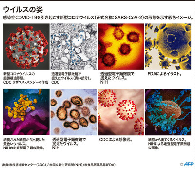 図解 新型コロナウイルスの姿 写真11枚 国際ニュース Afpbb News