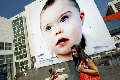 腹部に針を刺さないダウン症診断法、2年以内に普及の可能性