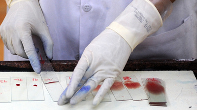 大西洋の海面温度、インドのマラリア流行の指標に 米研究