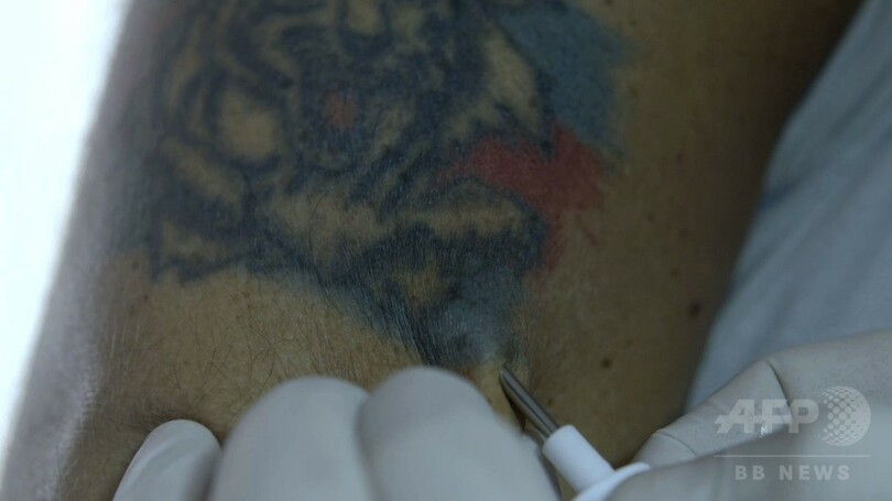 チームは体の一部？ アルゼンチンでマイクロチップ入場券発売