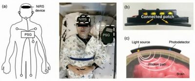 睡眠中に働く「脳の清掃システム」リアルタイム測定…韓国の研究チーム「認知症克服」のカギとなるか