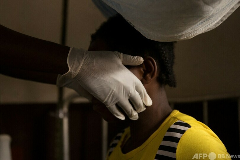 サル痘、感染加速の恐れ WHO欧州事務局が警告