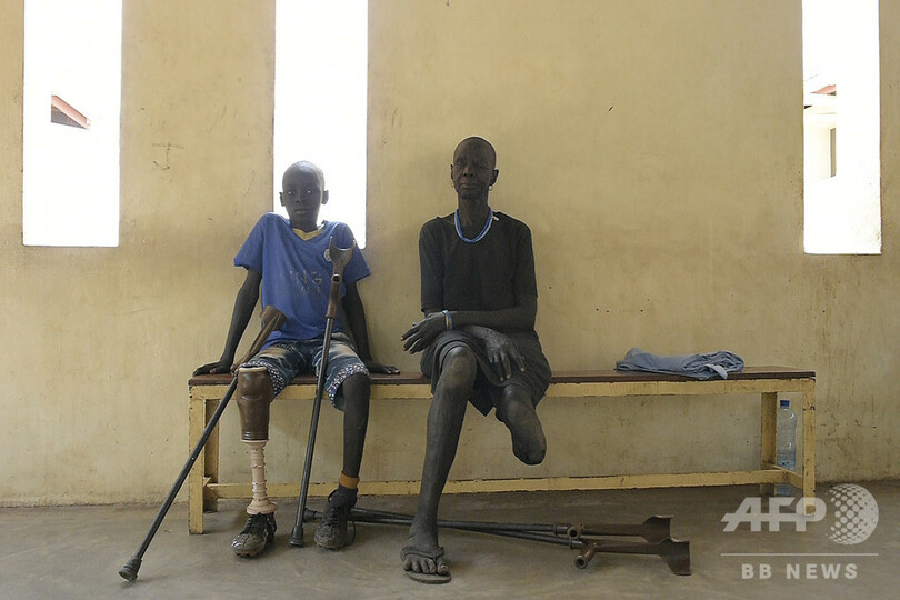 内戦で数万人が手足失い…全国から義肢求めて訪れる施設 南スーダン