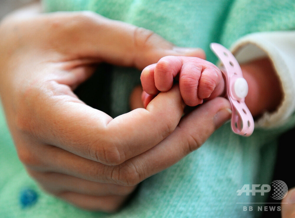 顔のない赤ちゃん生まれる 医師に6か月の停職処分 ポルトガル 写真1枚 国際ニュース Afpbb News