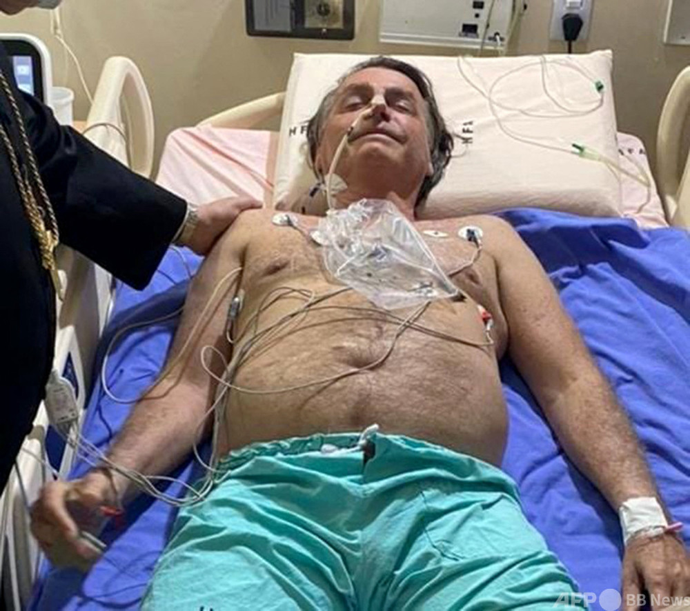 ブラジル大統領、しゃっくり止まらず入院 腸閉塞で要手術か