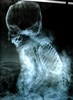 ボリビア当局が押収した女の子のミイラのX線写真（2012年11月6日撮影）。(c)AFP/MINISTRY OF CULTURE