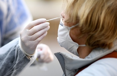 新型コロナウイルスによる重度肺疾患、発症する患者をAIで予測 研究