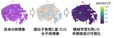 前がん病変の遺伝子発現で肝発がんのリスクを予測