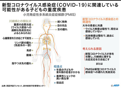 新型コロナに関連？ 子どもの謎の疾患が急増