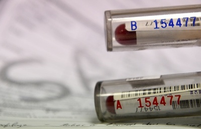 自転車団体が血液検査回数増を要求、闇の薬物組織の存在も懸念