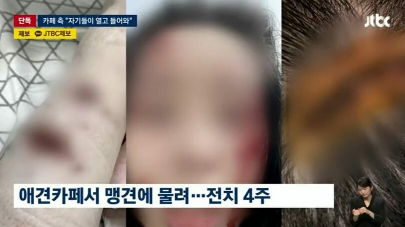 負傷した女性＝JTBCニュースルーム放送画面キャプチャ(c)MONEYTODAY