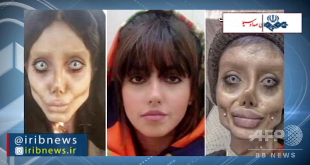 美容整形で ゾンビ 顔に 有名インスタグラマーが後悔語る イラン 写真4枚 国際ニュース Afpbb News