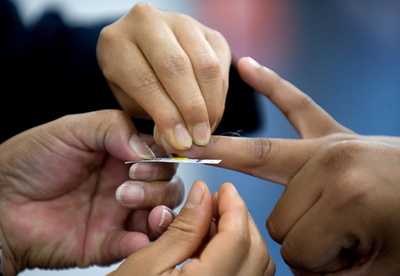 高コレステロール、遺伝子原因はわずか2％ 米研究