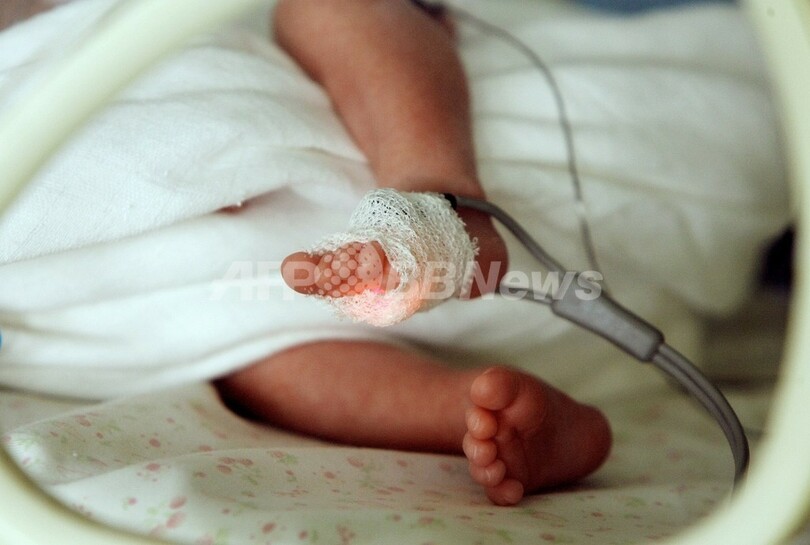 死亡宣告受けた未熟児 自宅で息を吹き返す パラグアイ 写真1枚 国際ニュース Afpbb News