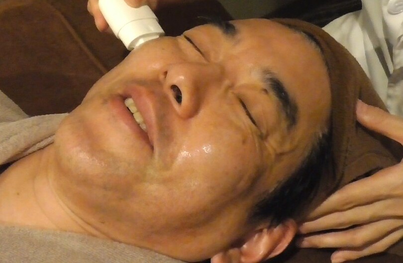 ダーマスタンプによる施術を受けながら「ちょっと痛い」と苦笑いする米村さん(c)KOREA WAVE