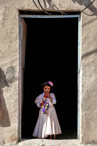 「大きな黒いアザ」で孤立する4歳少女、医療システム崩壊のイラク