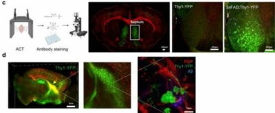 韓国脳研究院、認知症初期のシナプス損傷の原因を究明